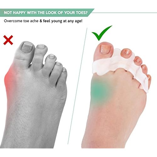 Toe Separators - Yoga Massage Ball - for Bunions, Hammertoe - Foot Pain Relief by ProTragen Beauty & Personal Care, Foot, Hand & Nail Care, Tools & Accessories, Toe Separators