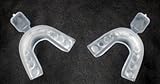 Pristine Teeth Whitening Mouth Trays by Pristine Teeth Whitening