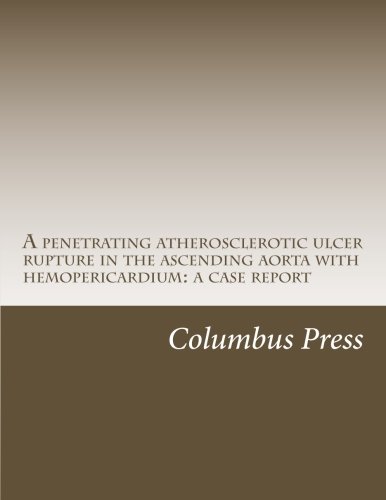 A penetrating atherosclerotic ulcer rupture in the ascending aorta with hemopericardium: a case report