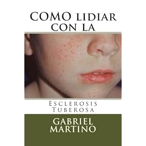 COMO lidiar con la Esclerosis Tuberosa (Medicina cotidiana) (Volume 1) (Spanish Edition)