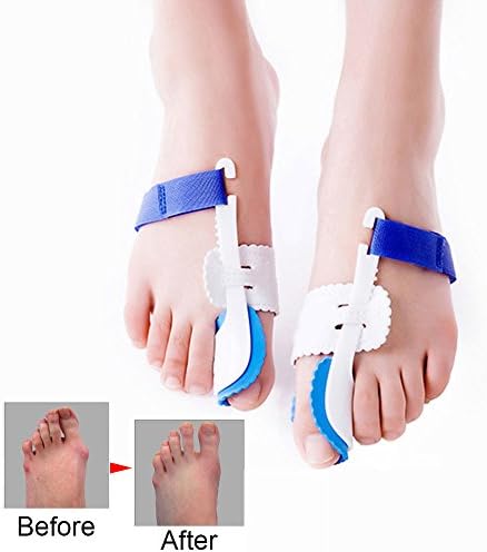 Bunion Corrector, 2pcs Adjustable Velcro Bunion Splint Protector Sleeves for Hallux Valgus Tailors Bunion Hammer Toe Pain Relief Includes Big Toe Strap-Sleeping Hold for Women&amp;Men