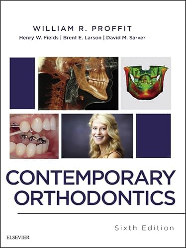 Aligner Orthodontics and Orofacial Orthopedics - Kindle edition by