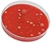Blood Agar Plate, 5 Percent Sheep Blood in Tryptic Soy Agar (TSA) Base, 15x100mm Plate, Order by The Package of 10, by Hardy Diagnostics.