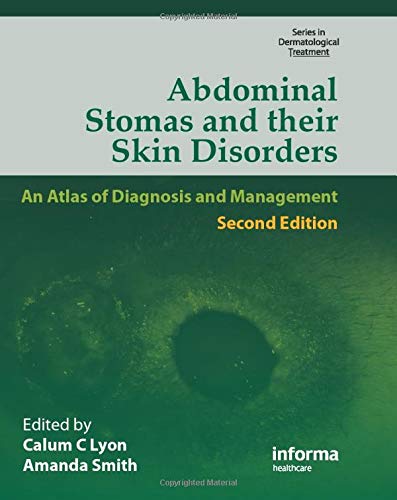 Abdominal Stomas and Their Skin Disorders (Series in Dermatological Treatment) - Thumbnail 3
