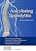 Ankylosing Spondylitis