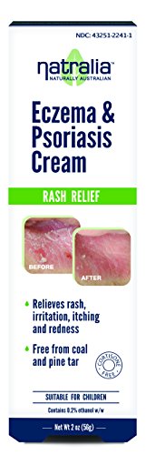 Natralia Eczema & Psoriasis Cream, 2 Ounce Tube