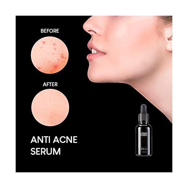 IMIM-Acne-Treatments-Serum-Double-Strength-Spot-Blemishes-Blackheads-Removal-Treatment-Suitable-for-Prone-to-Acne-Face-Serum-for-All-Skin-Types IMIM Acne Treatments Serum Double Strength Spot Blemishes Blackheads Removal Treatment Suitable for Prone to Acne Face…