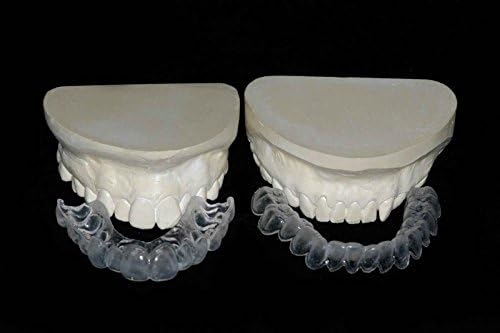 Custom Teeth Whitening Trays Full Kit w/Gel Direct from Our Dental Lab, Professional Upper and Lower Bleaching Trays, Buy Direct and Save. Whiter Smile Labs