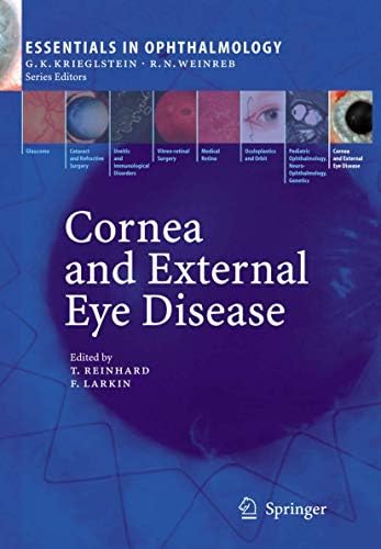 Glaucoma: 2-Volume Set: 9780702051937: Medicine & Health Science