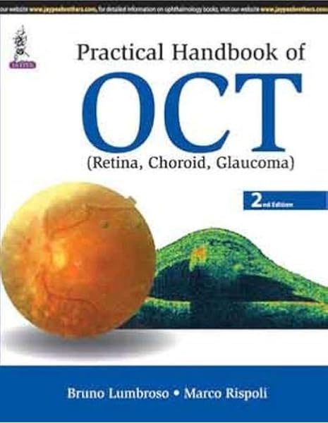 Practical Handbook Of Oct Retina Choroid Glaucoma 9789351525318 Medicine Health Science Books Amazon Com