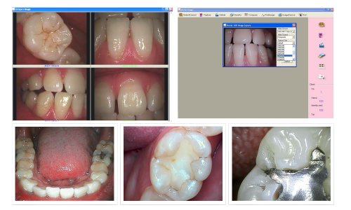 2 FocusDent+MD740+Dental+Intraoral+Camera