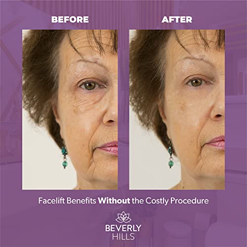 Beverly Hills Instant Facelift Anti Aging Eye Serum Treatment for Dark