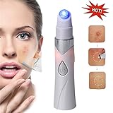 ZDU 2018 Powerful Anti-varicose Veins Face Acne Removal Pen Blue Light Therapy Treatment Pen for Anti-Inflammation, Acne Scar Removal, Improve Skin Elasticity,Skin Tightening Wrinkle Removal Treatmen
