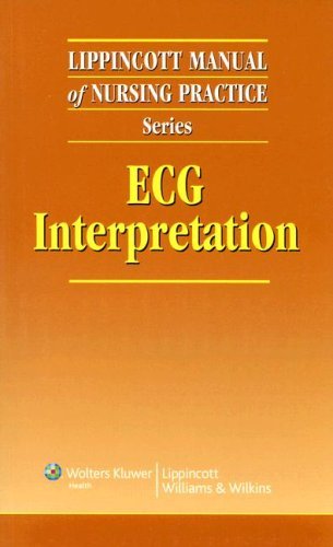 Ecg Interpretation Lippincott Manual Of Nursing Practice Series By Springhouse 2007 06 01 Springhouse Amazon Com Books