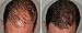Hair Building Keratin Fibers - Conceal Hair Loss, Add Thickness and Body, and Thicken Thinning Roots - for Men and Women by Beverly Hills (Black)