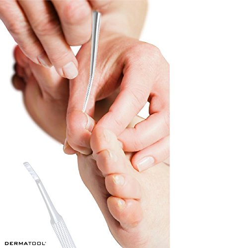 Ingrown Toenail Treatment Tool Podiatrist Premium Set by DERMATOOL
