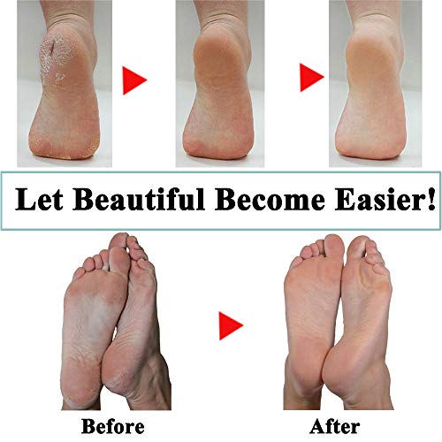 It is important to note that these replacement roller heads are only compatible with Pedi Perfect Electronic Foot File and should not be used with any other device. Regular replacement of the rollers is recommended to ensure that the device continues to work effectively and keep feet looking and feeling their best. Description by ChatGPT.