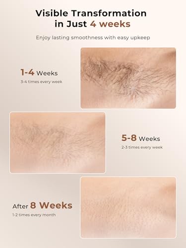 IPL Devices Hair Removal with Cooling Function, Laser Hair Removal with 9 Adjustable Energy Levels, 999900 Flashes & 600 NM Red Light, Painless IPL Hair Removal Device for Women & Men, Gold