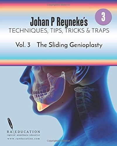 Download Johan P. Reyneke's Techniques, Tips, Tricks and Traps Vol 3: The Sliding Genioplasty PDF
