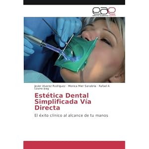 Estética Dental Simplificada Vía Directa: El éxito clínico al alcance de tu manos (Spanish Edition)