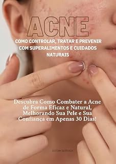 Livro ACNE: Como Controlar, Tratar e Prevenir Com Superalimentos e Cuidados Naturais: Descubra Como Combater a Acne de Forma Eficaz e Natural, Melhorando Sua ... Dias! (Superalimentos para a Saúde Livro 1)