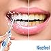 Nicefeel® Water Flosser Oral Irrigator Dental Care Power FC-168