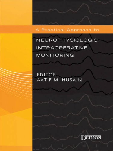 A Practical Approach to Neurophysiologic Intraoperative Monitoring - //medicalbooks.filipinodoctors.org
