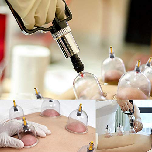 Cupping Set,Professional Chinese Acupoint Cupping Therapy Sets Suction