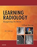 Learning Radiology: Recognizing the Basics