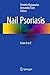 Nail Psoriasis: From A to Z