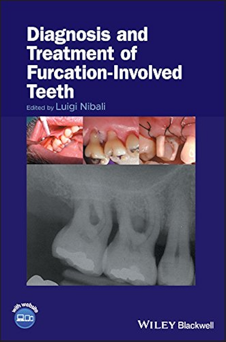 Download Diagnosis and Treatment of Furcation-Involved Teeth (English Edition) PDF