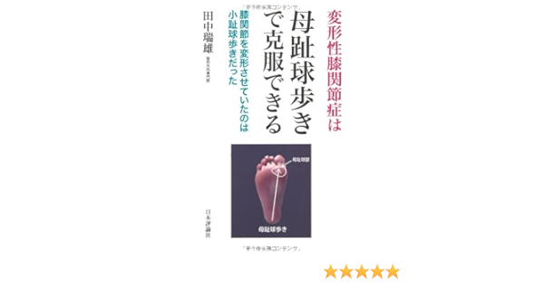 変形性膝関節症は母趾球歩きで克服できる 膝関節を変型させていたのは小趾球歩きだった Amazon Es Libros