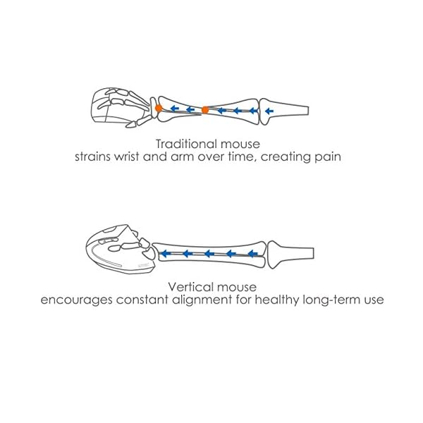 Anker® Ergonomic Optical USB Wired Vertical Mouse 1000 / 1600 DPI, 5 Buttons