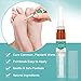 Wart Remover,Foot Wart Remover,Plantar Wart Remover,Wart Remover Liquid Pen Corn Callus Remover Liquid for Common Warts Plantar Corn Callus Stops Wart Regrowth