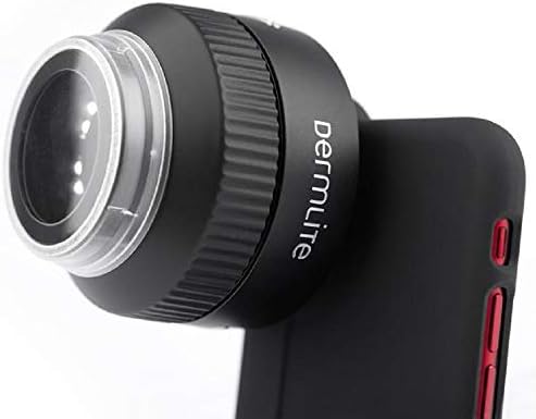 3Gen DermLite Foto X Digital Epiluminescence Dermascope Microscope