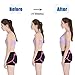Premium Back Posture Corrector for Women & Men & Kids, Back Support Brace, Pain Relief Upper Back & Shoulder Brace, Perfect for Clavicle Support