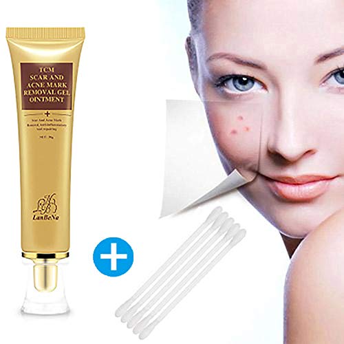 LtrottedJ Acne Scar Removal Cream Skin Repair Face Cream Acne Spot 30ml
