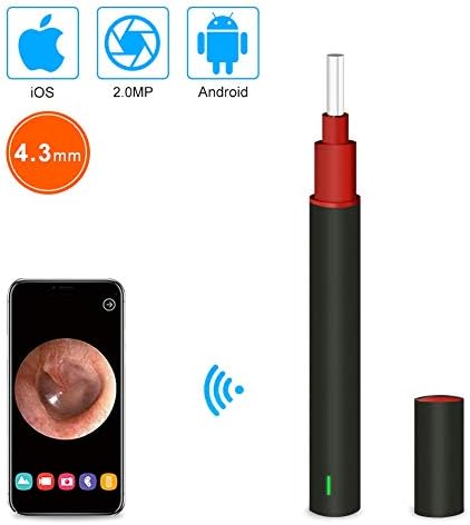 Ear Inspection Camera, Wireless Ear Otoscope 1080P with 6 LED Lights Ear Endoscope Camera
