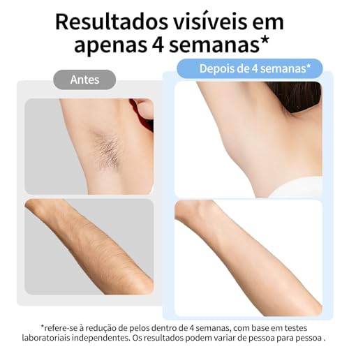 Depilador a Laser IPL Ulike ME Luz Pulsada Indolor Ice Cooling com Resfriamento Safira, 4 Modos, Disparo Automático (3/s), Depilação Corporal e Facial, Uso Doméstico, Certificado pela ANVISA, Bivolt, Presente Ideal Feminino
