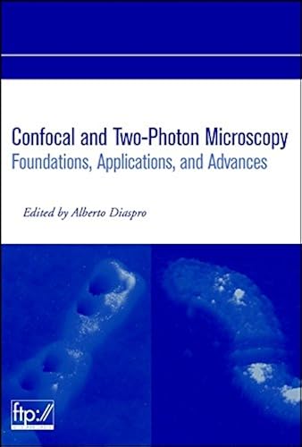 Download Confocal and Two–Photon Microscopy: Foundations, Applications and Advances PDF