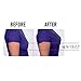 Breast Tape, Invisible Breast Lift Tape Medical Grade Strapless Backless Bra Tape For All Cups, Breast Super Lifted Star's Trick(16.4Ft)