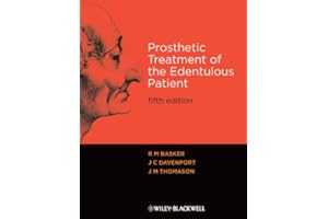 Prosthetic Treatment of the Edentulous Patient
