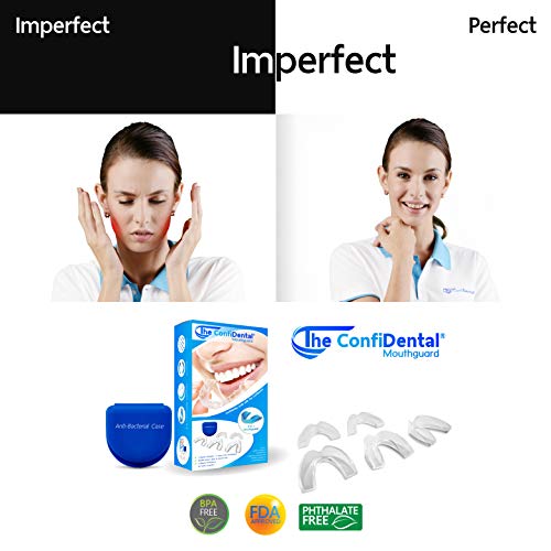 5 ConfiDental+Moldable+Clenching+Whitening+Including