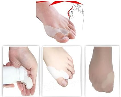 ALIVIA JUANETES HALLUX VALGUS DOLOR JUANETE DEDOS TORCIDO ORTOPEDIA PIE