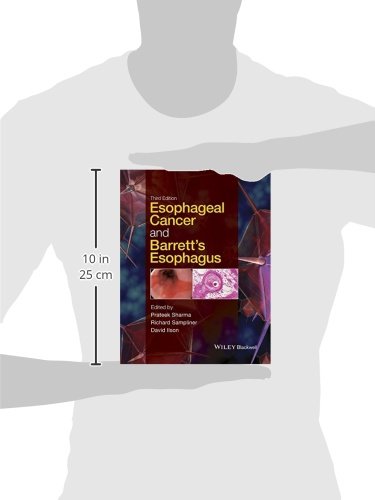 Esophageal Cancer and Barrett's Esophagus