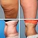 Slimming Hot Cream Anti-cellulite Treatment Cream – Skin Tightening Cream Firming for Full Body Massager Fast Burning Fat – HOT Chilli Gel Cream for Weight Loss (1-HOT)