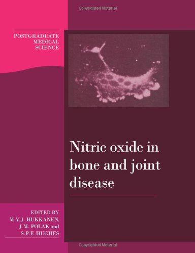 NITRIC OXIDE IN BONE AND JOINT DISEASE