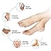 TENMAND Adjustable Heel Protectors- Silicone Gel Heel Pads Cushion Cups for Bone Spur Heal Dry Cracked Heels Achilles Tendinitis Relief Plantar Fasciitis Inserts for All Size Feet of Men & Women