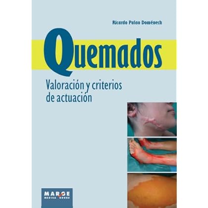 Quemados. Valoración y criterios de actuación Quemados. Valoración y criterios de actuación
