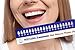 6 Pack Professional 3D Teeth Shade Guide with Whitening Daily Progress Log by Accu White (6 Pack, 6 week Supplies)